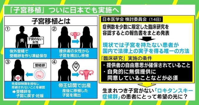 「自分の子宮を娘に」“子宮移植”は希望の光になるか 現役医師が語る課題 1枚目
