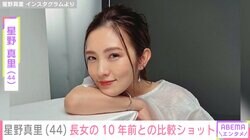 星野真里、指定難病「先天性ミオパチー」を患う長女 10年前と同じポーズで写真「こんなに大きくなりました」