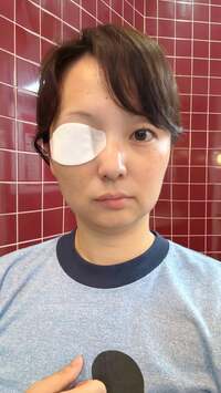 早坂まき子『顔面神経麻痺は悪化しています』