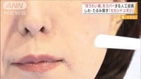 しわ・たるみ隠す？ほうれい線をカバーする人工皮膚
