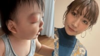 桃「こんなに腫れるの!?」左目が眼瞼下垂の次男の右目がパンパンに…
