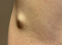 薬丸裕英『手術』