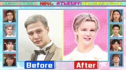 Matt、美容整形のビフォーアフターを披露「昔は家に帰るとパパが腰抜かしてた」