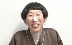 牧野ステテコが美容整形「若返りたい」イボ100個除去＆皺ボトックス＆ほくろ除去に挑戦