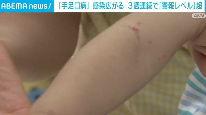 子どもの腕