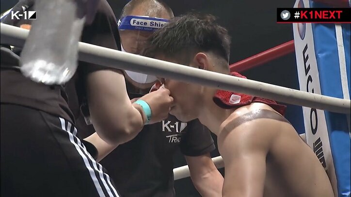 「変な音がした」鼻を破壊した戦慄の左ハイ “予言的中”のTKOに驚きの声