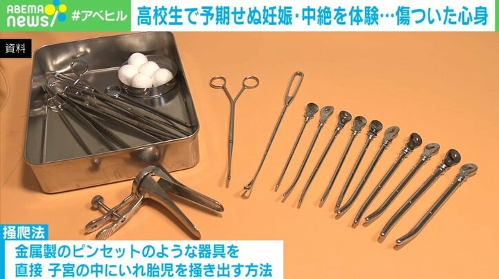高校時代に予期せぬ妊娠…国内初「経口中絶薬」が与える選択肢
