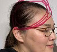 たんぽぽ白鳥久美子『抜け毛の始まり』