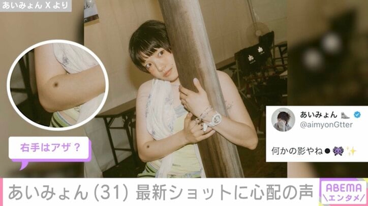 あいみょん Xより