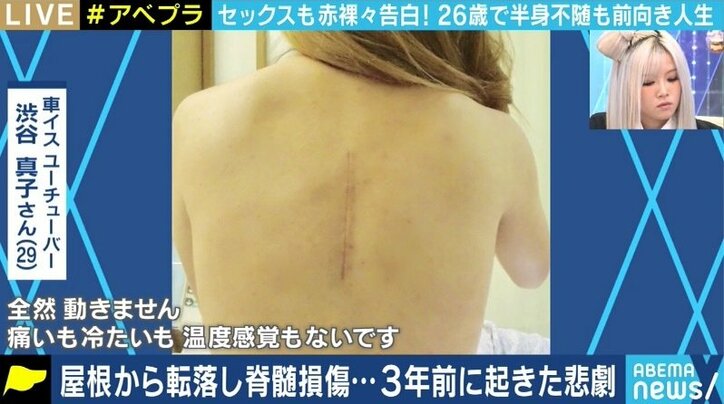 「同じ悩みを持つ女性たちが前向きになってくれるように」恋愛やセックスも諦めない!下半身麻痺の車椅子YouTuber渋谷真子さんに聞く