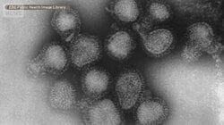 インフルエンザのピーク早まる　新変異株「サブクレードK」拡大　胃腸にも症状