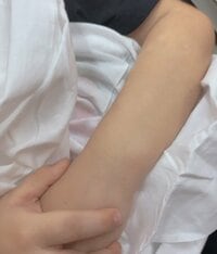 アレクサンダー『緊急病院行ってきました』