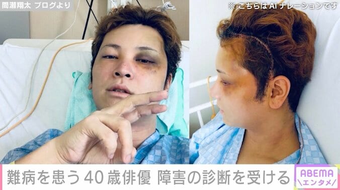 “10万人に1人”の難病を患う40歳俳優、 新たな障害の診断を受けたことを報告「本当に負のループ生活を生きています」 3枚目
