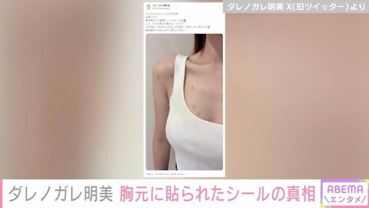 ダレノガレ明美「根性焼きではないのでご安心ください」胸元に貼られた複数のシールを説明