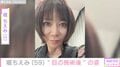堀ちえみ（59）、“目の施術後”の自撮り写真を公開「とっても好みな仕上がり」