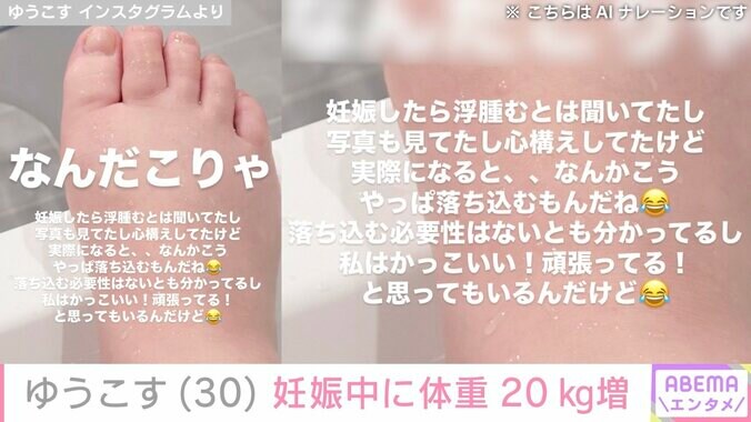 【写真・画像】水着姿が話題 ゆうこす（30）、妊娠中に体重が20㎏増「閲覧注意」むくんだ足を公開　2枚目