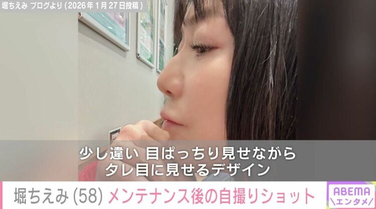 写真・画像】堀ちえみ（58）、メンテナンス後の自撮りショットに反響