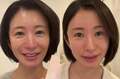  モデル・中村江莉香、美容整形後の自身のビフォーアフターを公開「驚きを隠せない」 