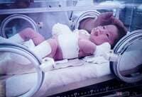 梅津真里奈『まりな爆誕①-表皮水疱症の診断がつくまで-』