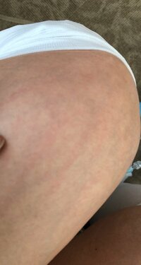 キンタロー。『出産レポート⑧身体に異変が』