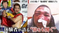 「鼻をも削ぐ思い」の実際の痛みをラウェイ元世界王者が語る「石をぶつけられている感じ」「鼻血が2カ月止まらない」…潰れてしまった鼻を見せて「全く高さがない」