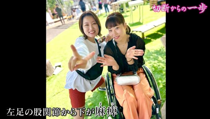 【写真・画像】「歩きたい、走りたい」足を切断した女性の“夢” 麻痺が残る中で“バドミントン”にも挑戦…義足作りの匠と共に歩む　2枚目