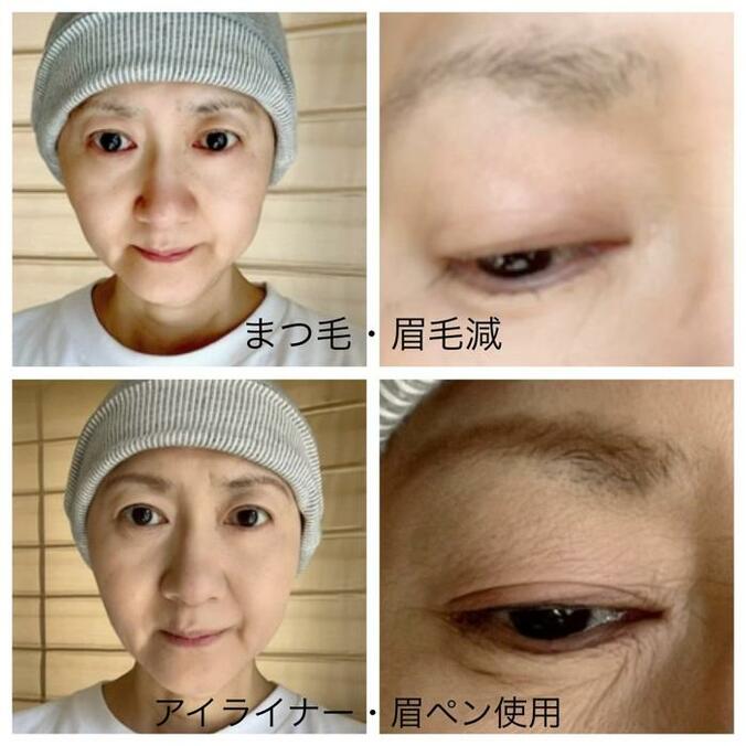  古村比呂、2回目の抗がん剤治療の副作用による脱毛で断念したこと「老眼のお年頃には」  1枚目