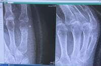 小柳ルミ子『経過観察の結果』