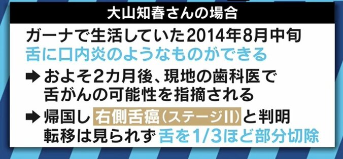 堀ちえみが「舌がん」告白…専門医「２週間以上続く口内炎は受診を」 6枚目