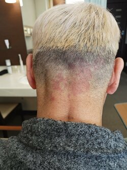 オール巨人、6度目の頚椎手術を決意し“刈り上げヘア”を披露「シルエットがHG君に似てませんか」