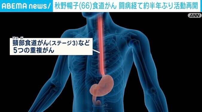 「のどの中に剣山があるような」 秋野暢子さんが約半年ぶりに活動再開 食道がん闘病、放射線治療の激痛でも前を向く“強さ” 2枚目