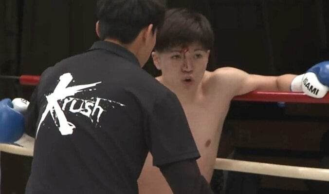 危険なバッティングで額“パックリ” 「足に来てる」「ダメージある」識者驚きの偶発的な瞬間 3枚目