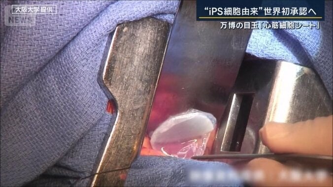 心筋細胞シート