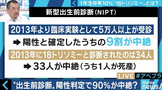 “1年以上の生存率は10％”…18トリソミー児の家族たちが写真展に託した苦悩と葛藤 4枚目
