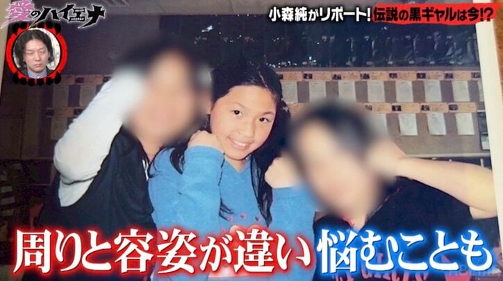 【写真・画像】伝説の黒ギャルから保育士に…33歳美女、保護者から心配されてることを明かす　2枚目