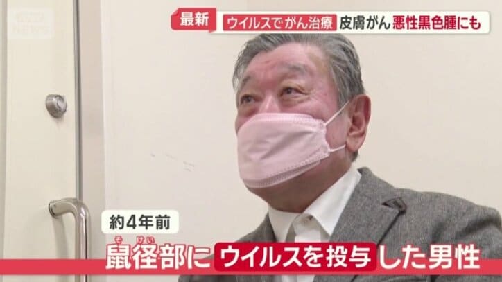 ウイルス療法の臨床試験を受けた患者（70代）