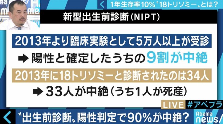 “1年以上の生存率は10％”…18トリソミー児の家族たちが写真展に託した苦悩と葛藤
