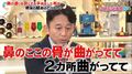 有吉、鼻の手術内容を告白 術後の“ハプニング”で担当医にヘルプも…マツコ驚き「結構な手術したのね!」