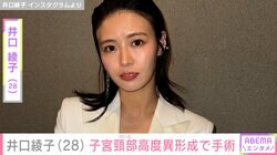 井口綾子（28）、子宮頸部高度異形成と診断され円錐切除術「気づかずにいたらと思うと少し怖い」
