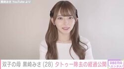 整形総額約2000万円・双子の母 黒崎みさ、“若気の至りで入れた”タトゥー除去の経過公開