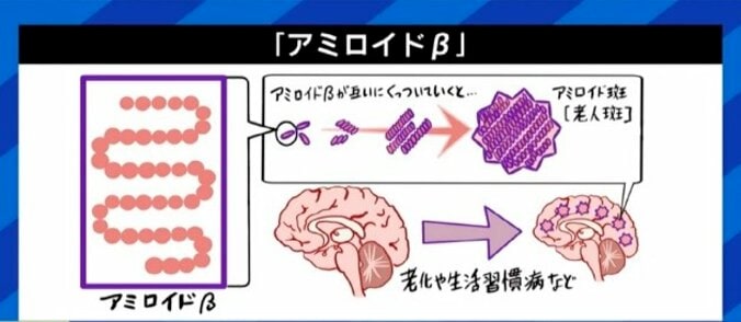 16年前の論文に捏造疑惑…世界の研究者の長年の努力は無駄に?今後の研究や創薬への影響は?『アルツハイマー征服』著者に聞く 4枚目