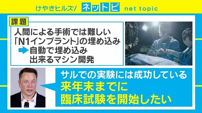 脳内埋め込み“チップ”で考えるだけでスマホ入力！ イーロン・マスク氏の新プロジェクトを徹底解説 3枚目