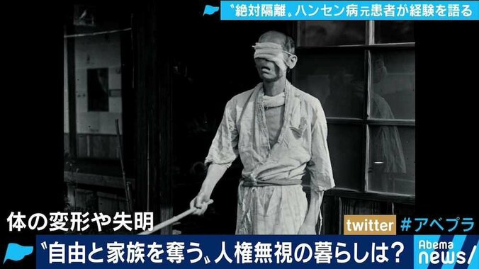 「二度と学校に来るな」と教師に言われた小６の夏から70年…差別や偏見と闘い続けてきたハンセン病回復者の半生 4枚目