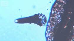 目のゴロゴロ「まつげダニ」？結膜炎＆ものもらい原因も　加齢とともに有病率が上昇