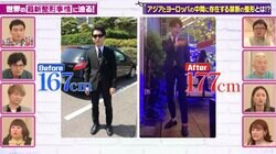 31歳イケメン医師、 “骨延長手術”で身長167cm→177cmに「モテるようになりました」費用も公開