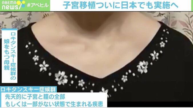 「自分の子宮を娘に」“子宮移植”は希望の光になるか 現役医師が語る課題 2枚目