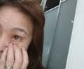  大島奈保美さん、結膜下出血を発症し瞼の下に溜まっていた血「多めだったのでかなりホラーな感じに」 
