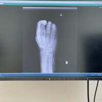 小柳ルミ子『えーっ⁉️こんなになってんの⁉️』