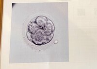 内山琴『妊娠について⑨採卵から3日後』