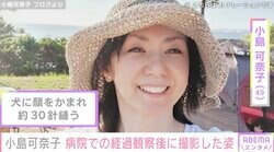 犬に顔をかまれ約30針縫った小島可奈子（49）、病院での経過観察後に撮影した自身の姿を公開